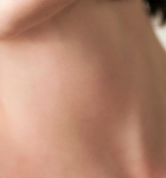 A Guide To Busting Dark Patches Of Skin Hero