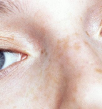 How To Choose The Right Concealer To Banish Dark Circles Hero