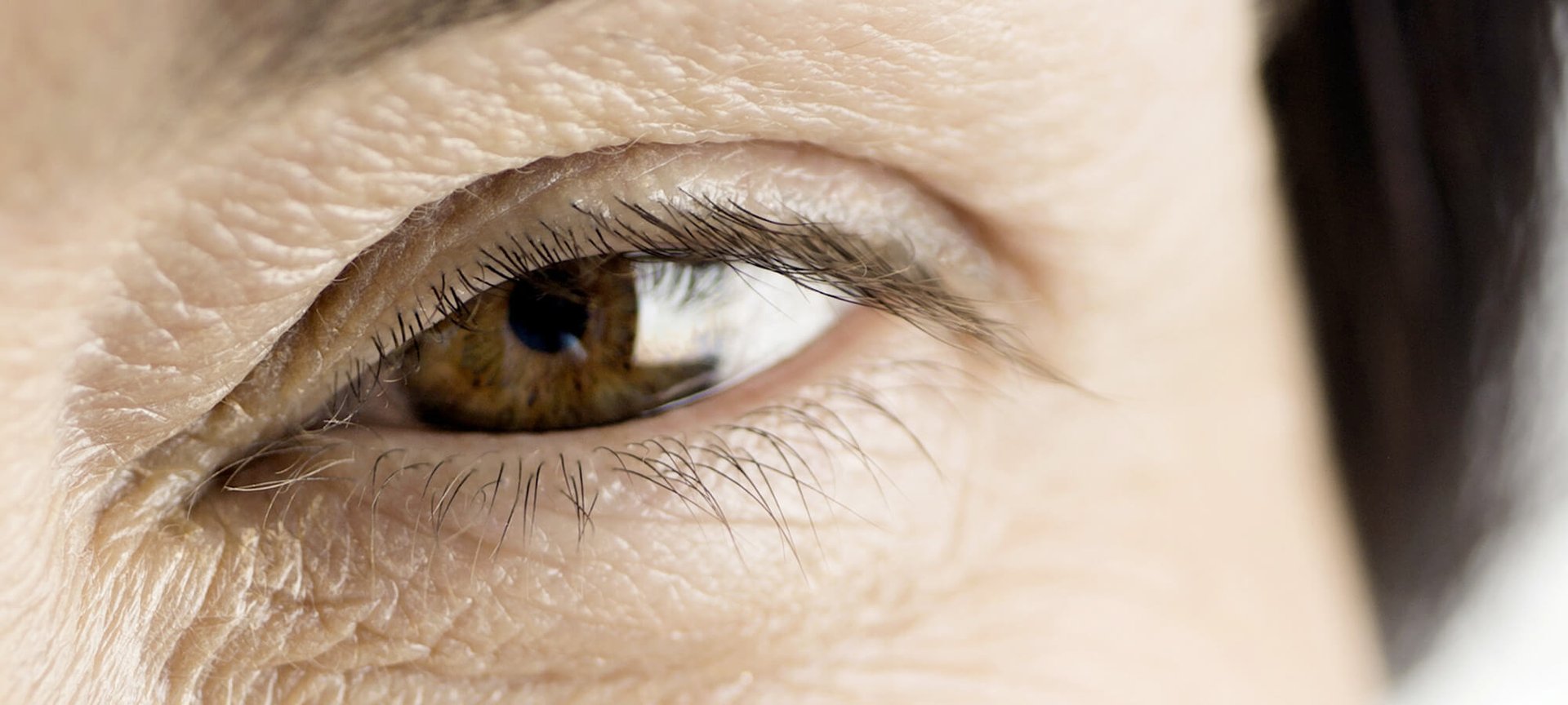 You Have Hit The Big 40 Time To Deal With Unwelcome Wrinkles Hero