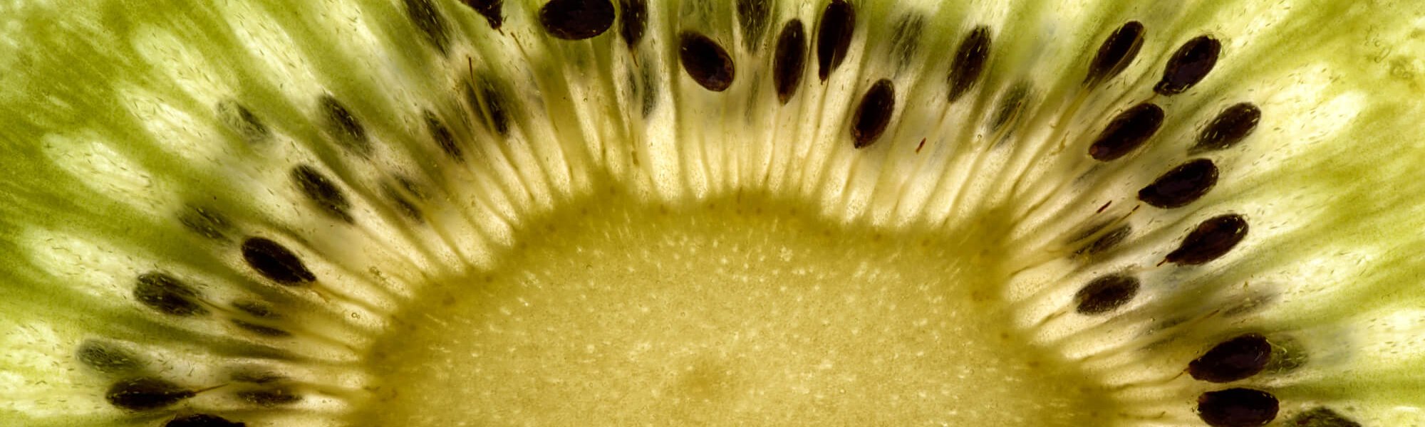 Five Foods To Avoid If You Want To Keep Your Perfect Skin Hero